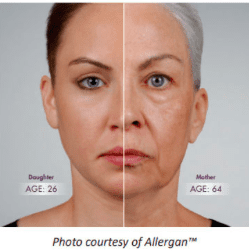 Image of a side by side of a daughter age 26 and mother age 64. Photo courtesy of Allergan(TM)